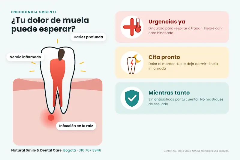 Muela con caries profunda, nervio inflamado e infección en la raíz, y señales para saber cuándo buscar endodoncia urgente