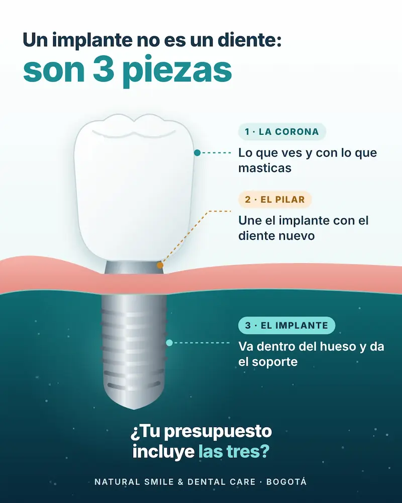 implante-dental-tres-piezas