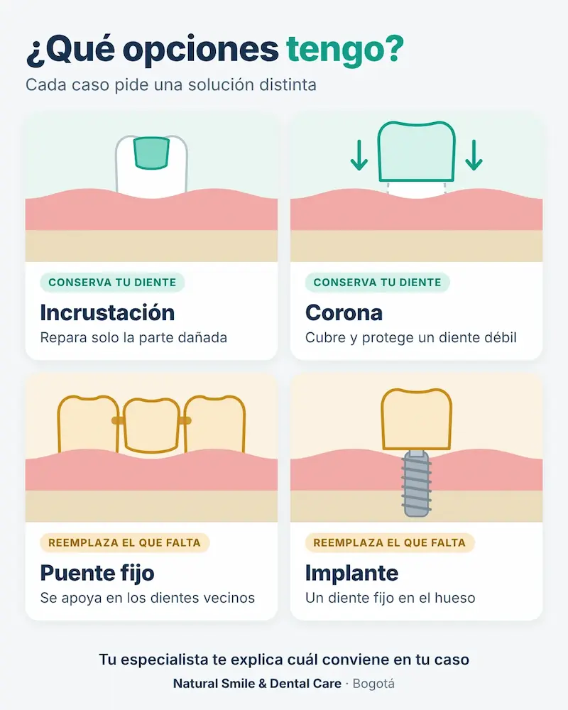 opciones-rehabilitacion-oral-incrustacion-corona-puente-implante