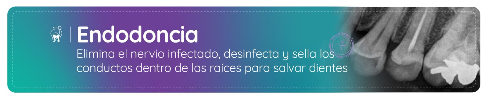 endodoncia bogota norte