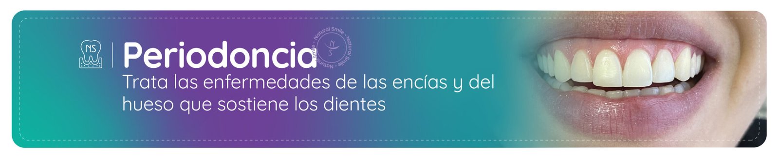 limopieza dental bogota norte