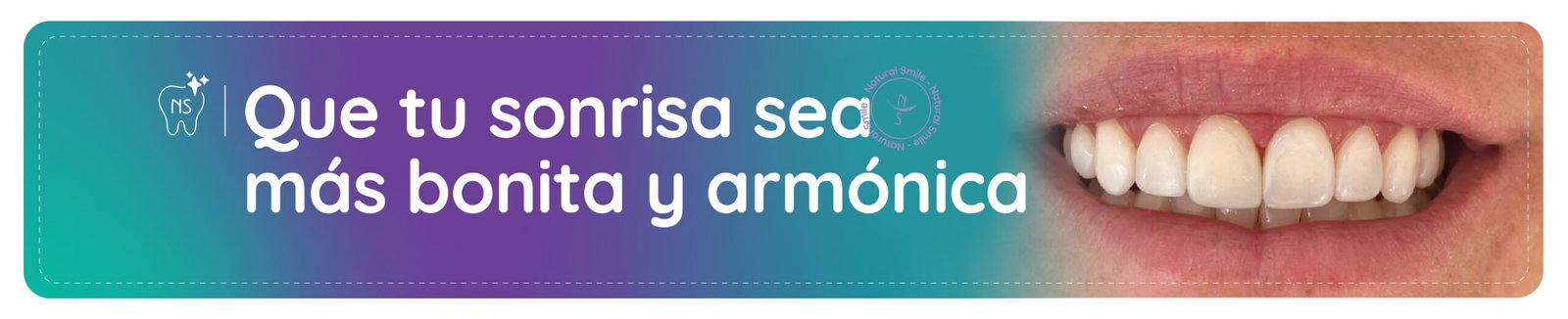 Diseño de sonrisa y odontologia estetica en bogota