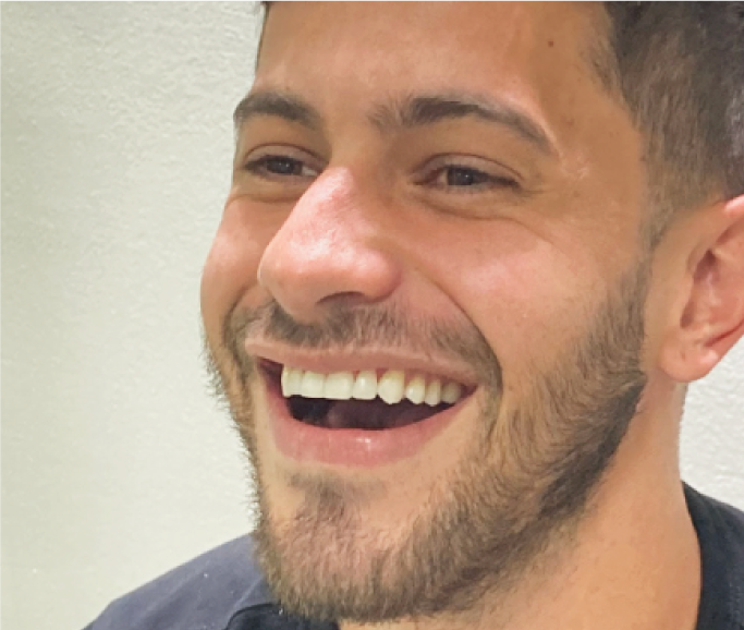 precio de diseño de sonrisa en Bogota norte