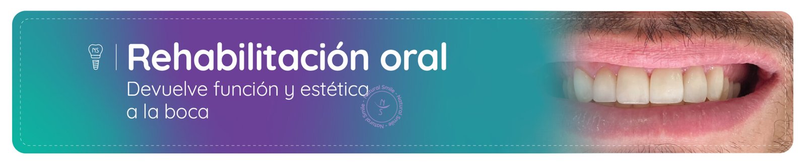 rehabilitacion oral bogota
