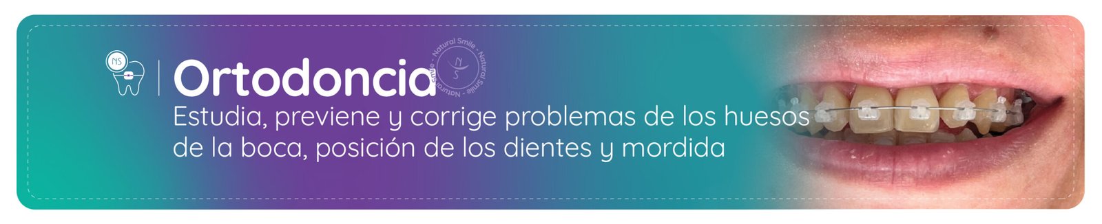 precio de ortodoncia bogota norte