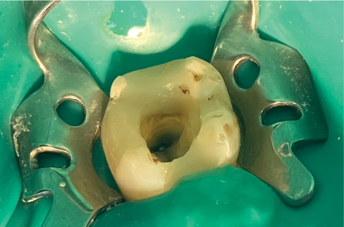 restauracion dental bogota